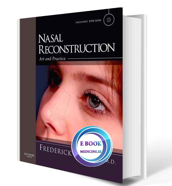دانلود کتاب Nasal Reconstruction: Art and Practice ( ORIGINAL PDF)